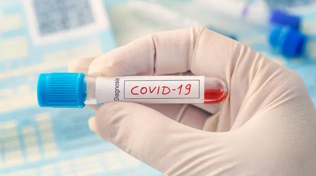 Szczepienia COVID-19